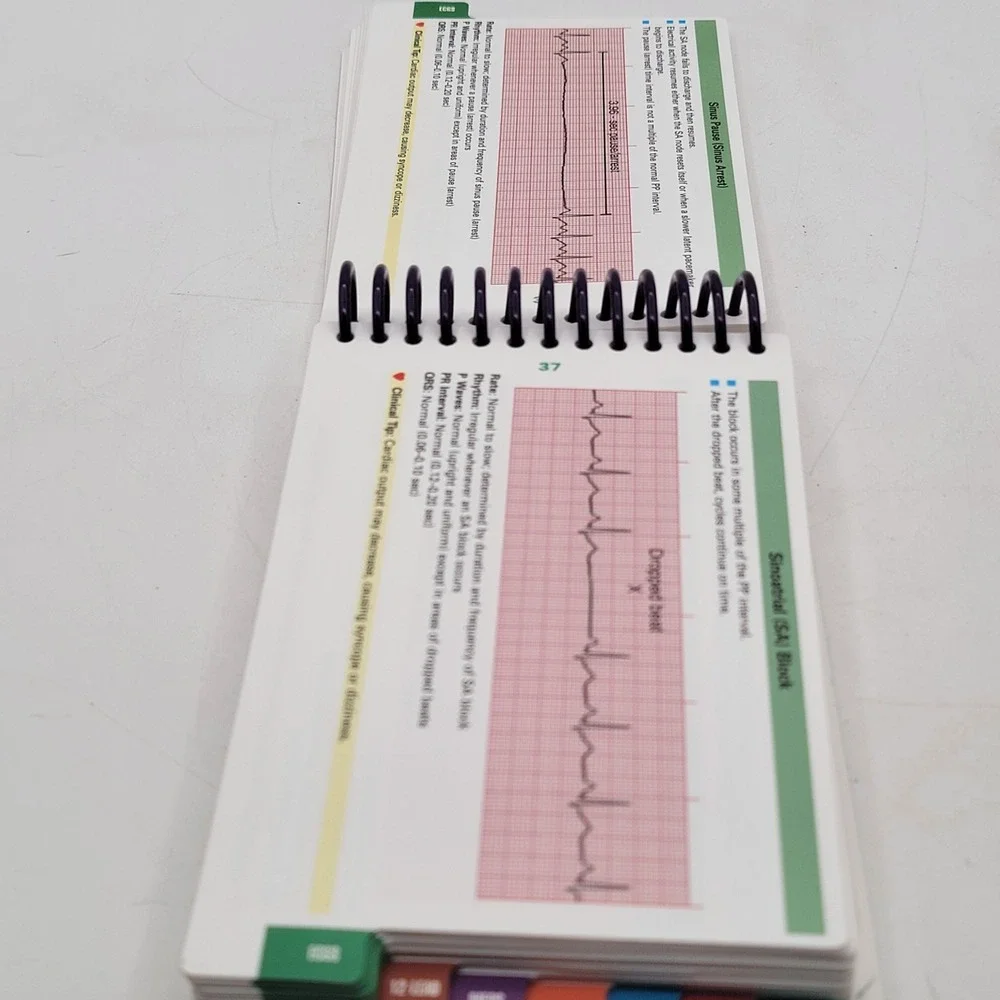 Shirley A Jones ECG Notes Interpretation and Management Guide Spiral 2nd Ed Ex